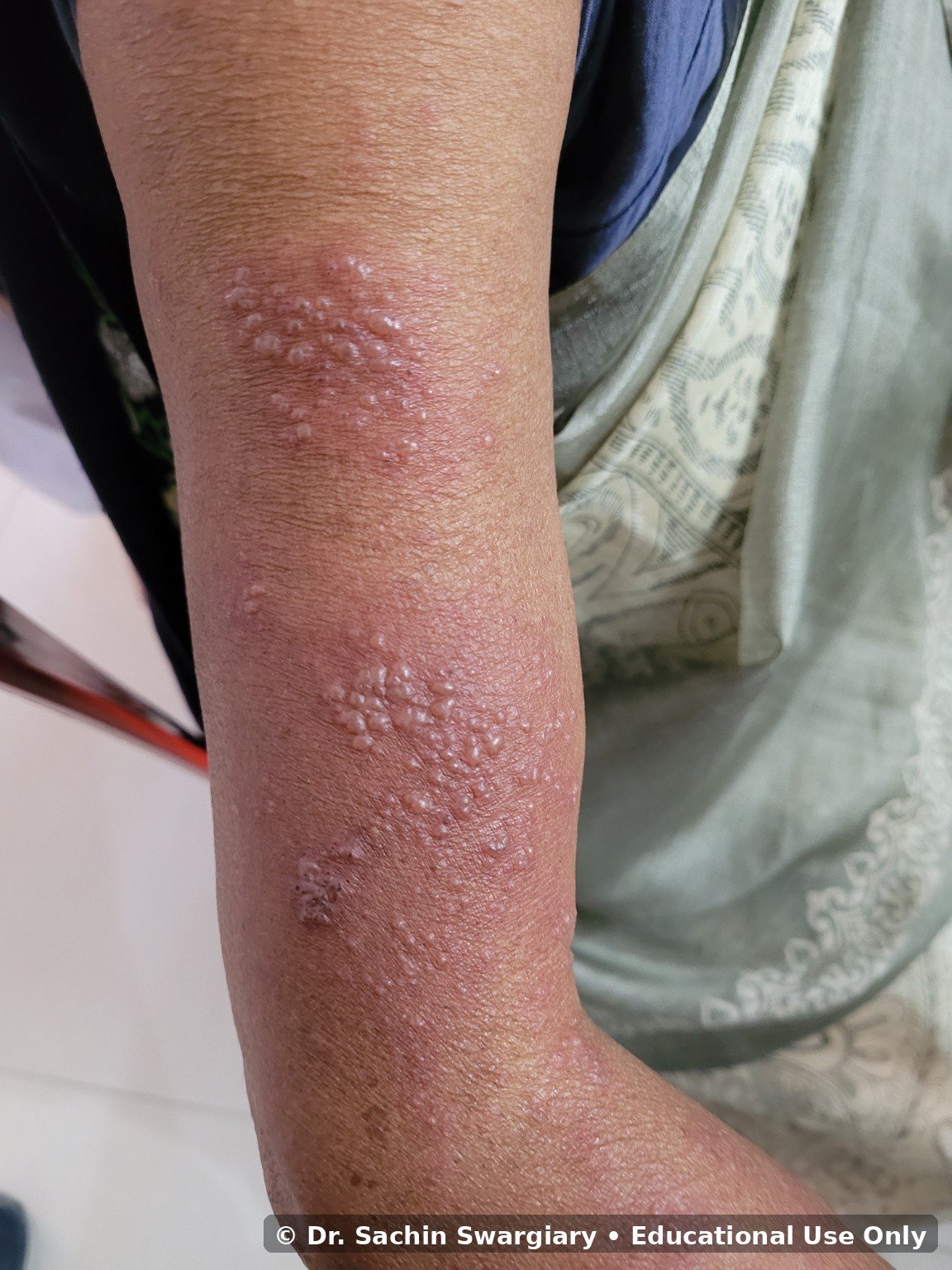 Clinical Gallery educational image 4