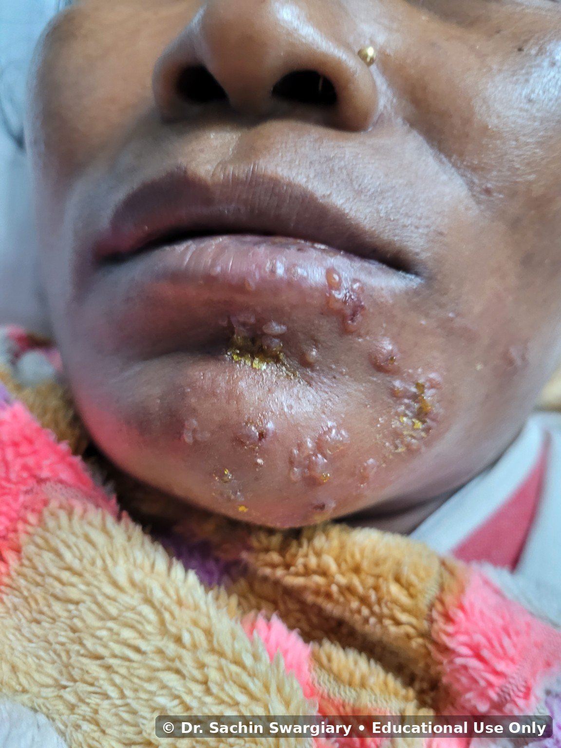 Clinical Gallery educational image 5