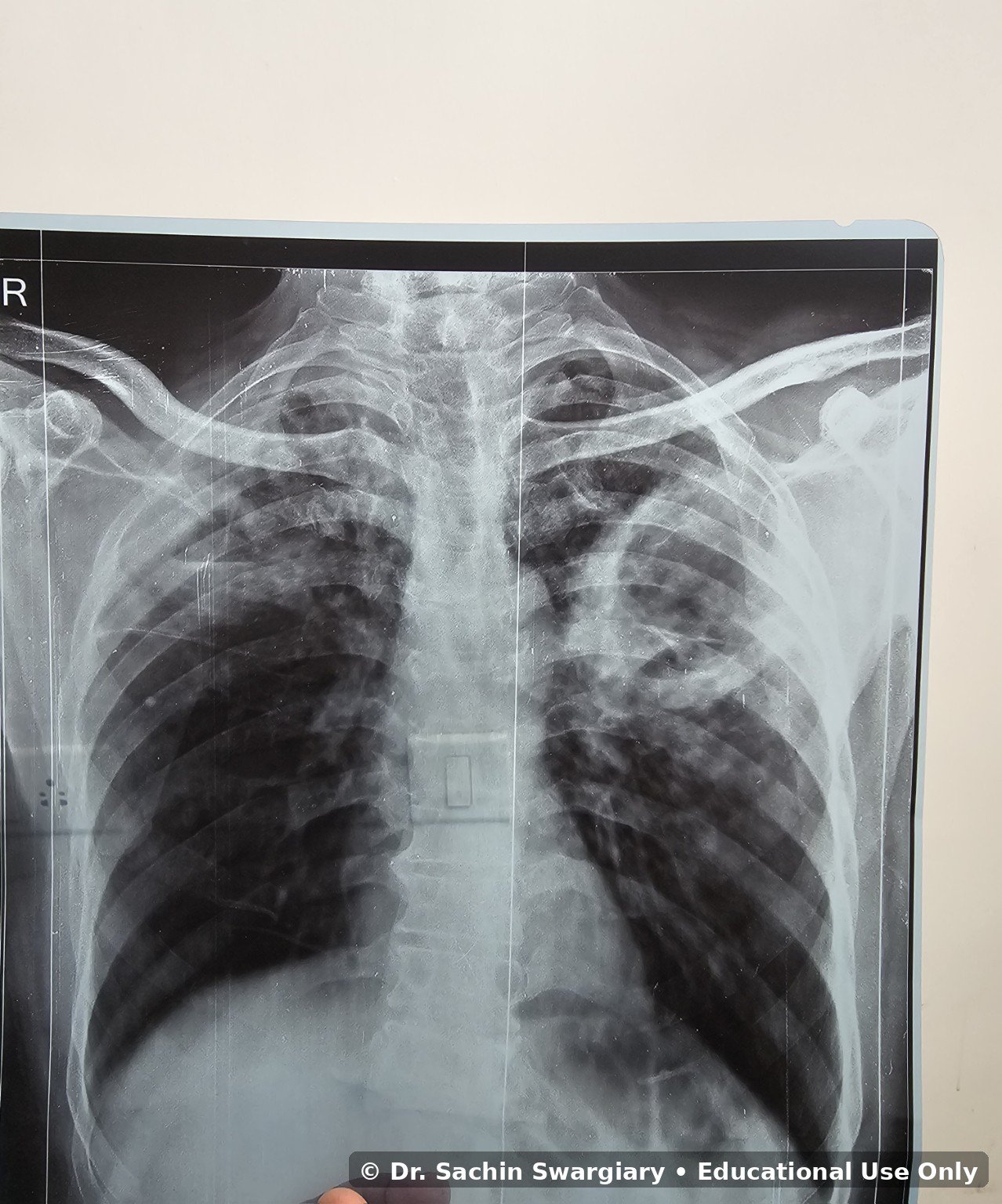 Clinical Gallery educational image 6