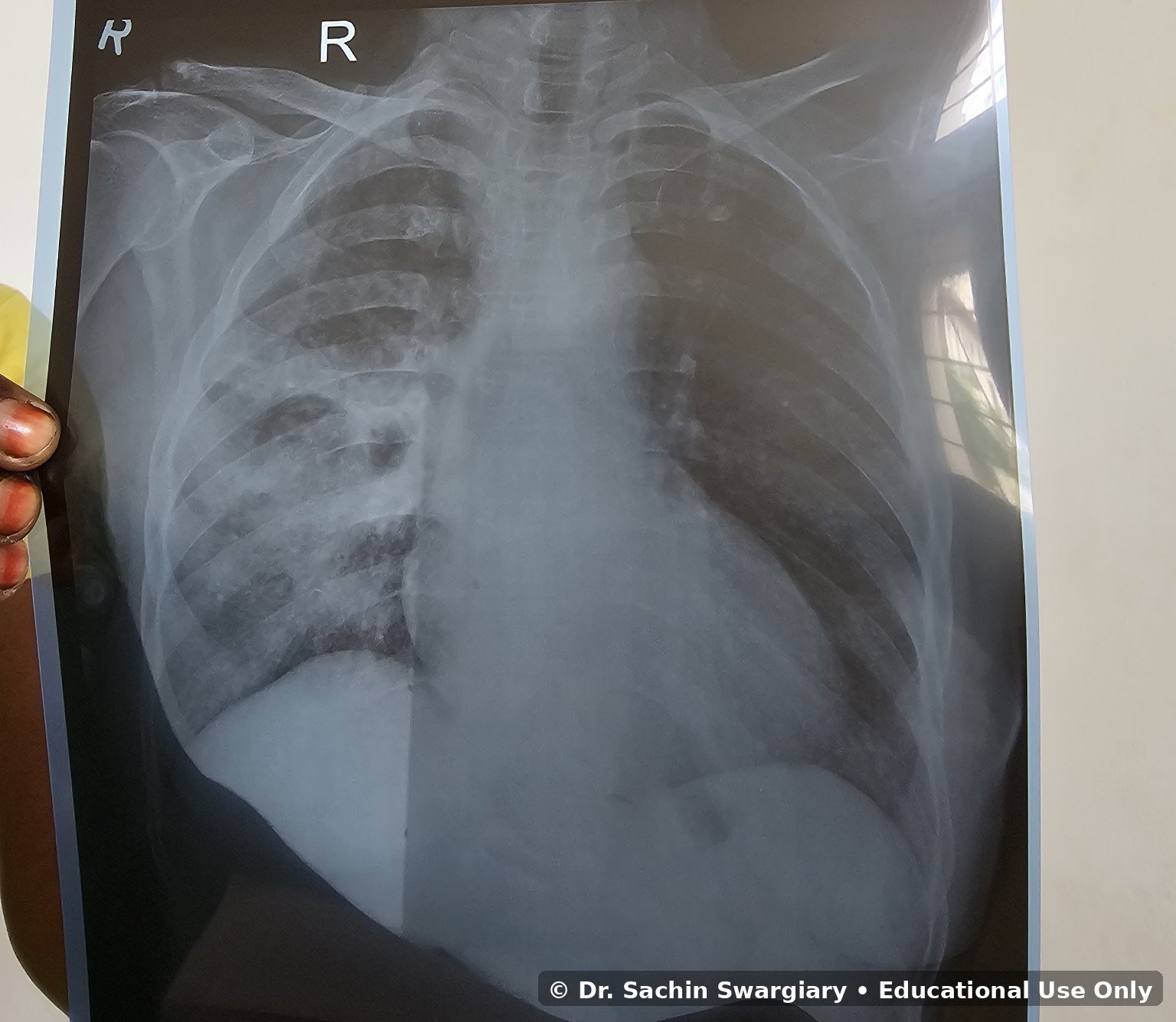Clinical Gallery educational image 8