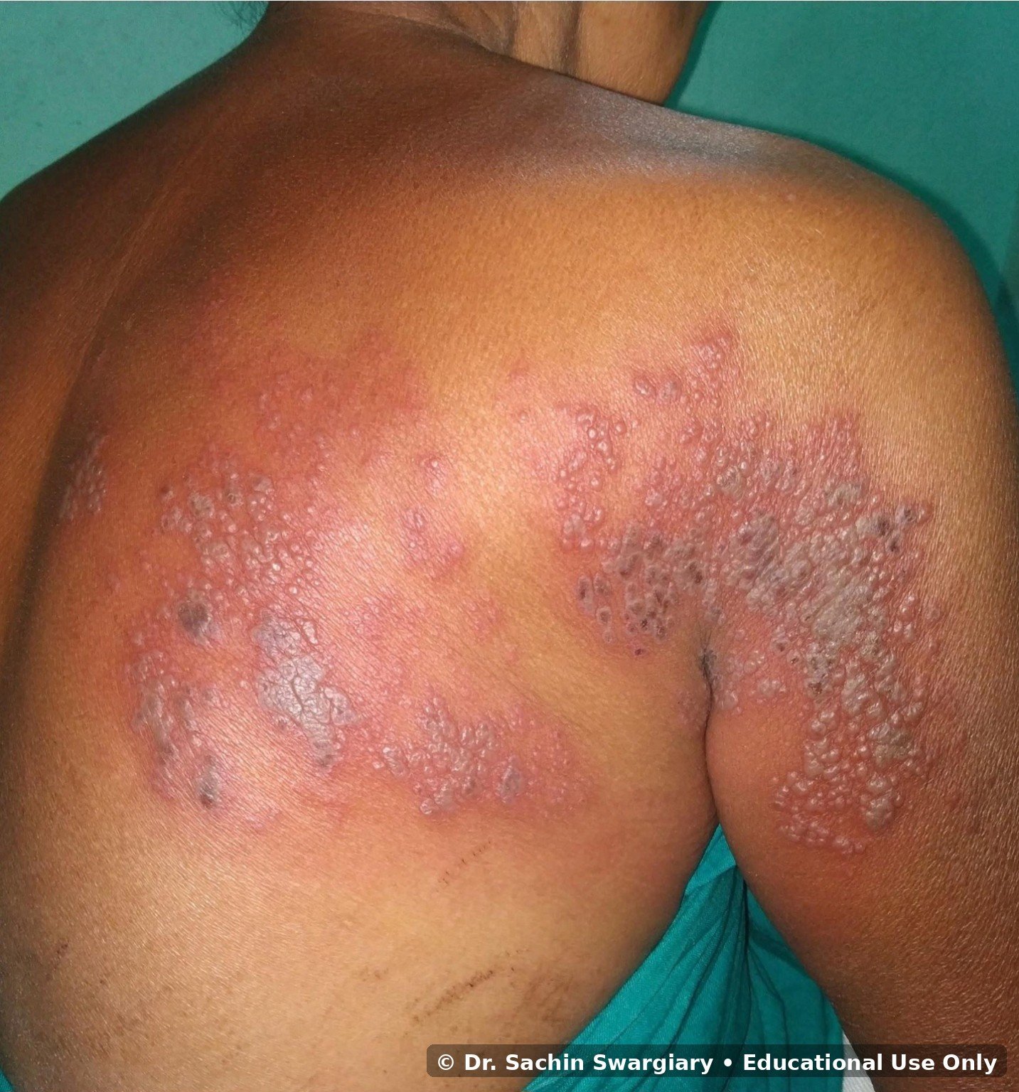 Clinical Gallery educational image 9